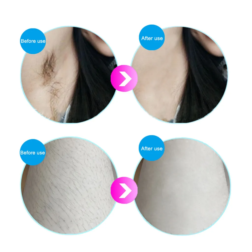 MENGS Haarentfernungsgeräte IPL Hautverjüngung Haarentferner Laserverjüngung Hair Remover Schönheitsinstrument Schmerzlos Mit Sonnenbrille – Bild 8