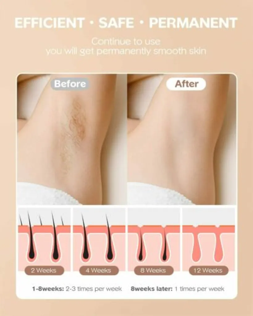 Fairywill INNZA 999000 Impulse Laser Haarentfernung IPL Haarentfernungsgerät Laser HaarentfernungGeräte Dauerhafte Haarentfernung Für Körper Gesicht Schmerzlos Epilierer Körper Mit Schutzbrille – Bild 4